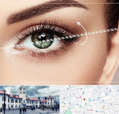 جراحی چشم گربه ای در میدان شهرداری رشت