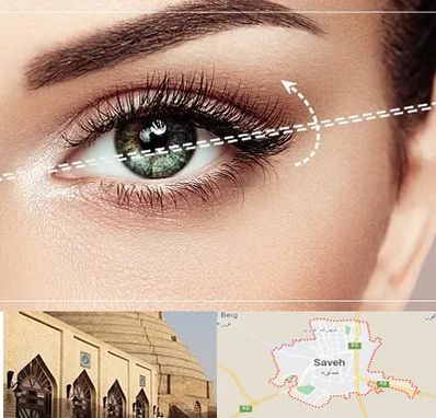 جراحی چشم گربه ای در ساوه