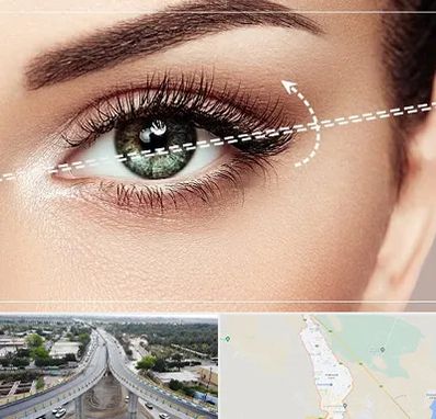 جراحی چشم گربه ای در اندیمشک