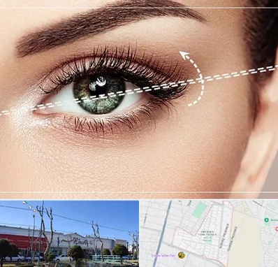 جراحی چشم گربه ای در فاز دو اندیشه