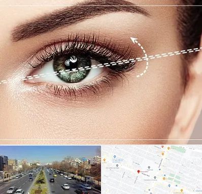 جراحی چشم گربه ای در بلوار معلم مشهد 