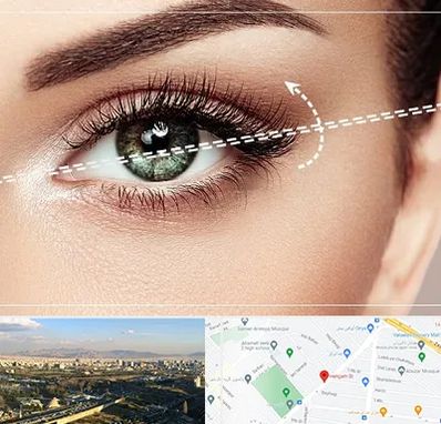 جراحی چشم گربه ای در هنگام 