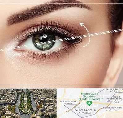 جراحی چشم گربه ای در نارمک 