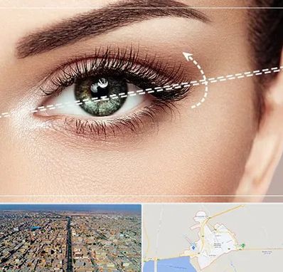 جراحی چشم گربه ای در بندر ماهشهر