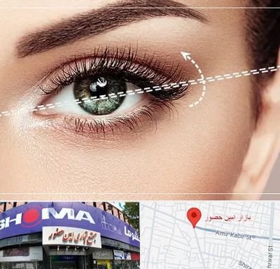 جراحی چشم گربه ای در امین حضور