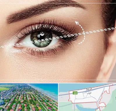 جراحی چشم گربه ای در نور