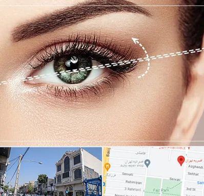 جراحی چشم گربه ای در افسریه 