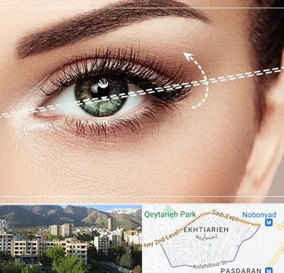 جراحی چشم گربه ای در اختیاریه 