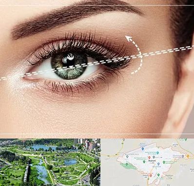 جراحی چشم گربه ای در بجنورد