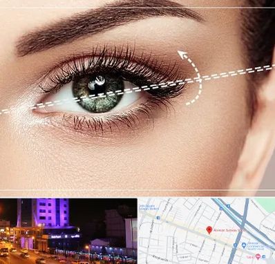 جراحی چشم گربه ای در آبرسان تبریز