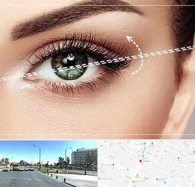 جراحی چشم گربه ای در بلوار کلاهدوز مشهد 