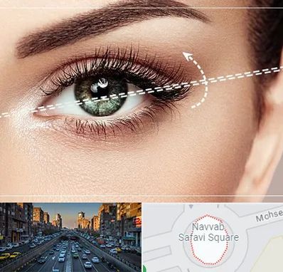 جراحی چشم گربه ای در نواب