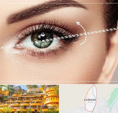 جراحی چشم گربه ای در دربند