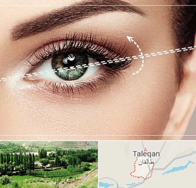 جراحی چشم گربه ای در طالقان