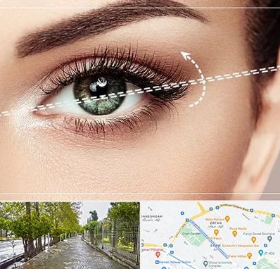 جراحی چشم گربه ای در خیابان ارم شیراز