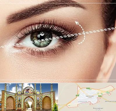 جراحی چشم گربه ای در سمنان