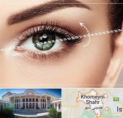 جراحی چشم گربه ای در خمینی شهر