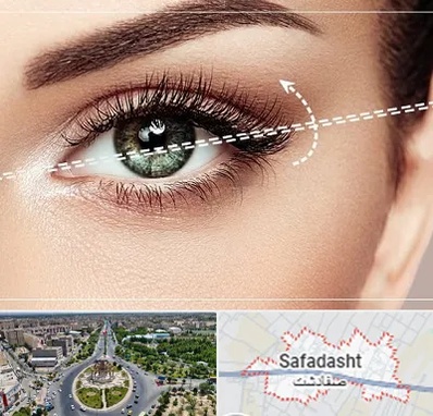 جراحی چشم گربه ای در صفادشت