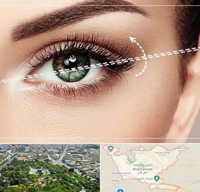 جراحی چشم گربه ای در شهرکرد