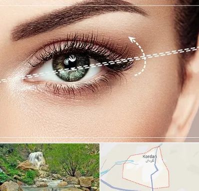 جراحی چشم گربه ای در کردان