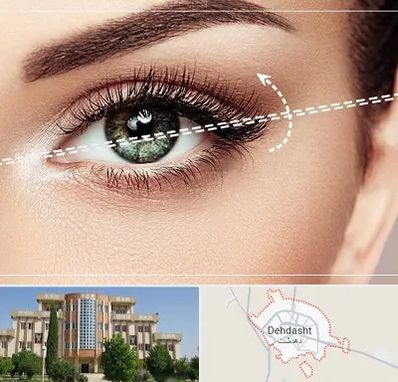 جراحی چشم گربه ای در دهدشت