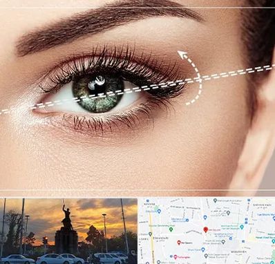 جراحی چشم گربه ای در میدان حر 