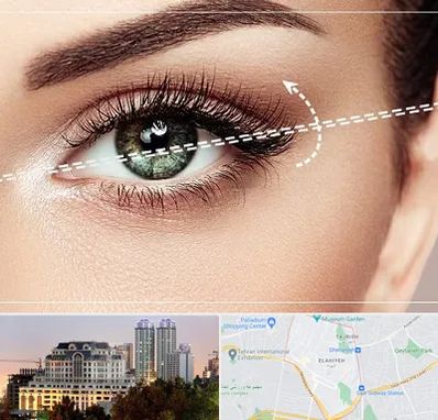 جراحی چشم گربه ای در فرشته 