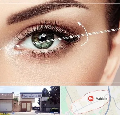 جراحی چشم گربه ای در وحیدیه شهریار
