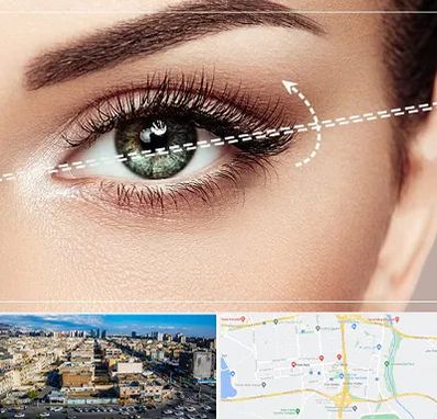 جراحی چشم گربه ای در شهرک راه آهن