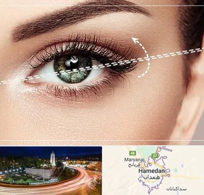 جراحی چشم گربه ای در همدان