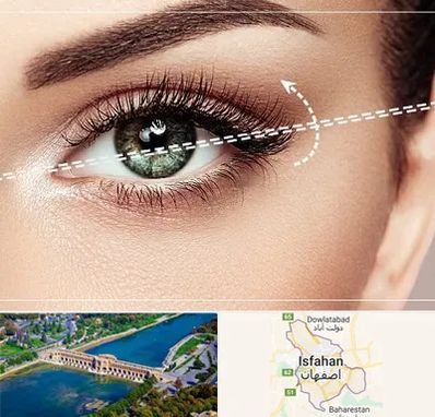 جراحی چشم گربه ای در اصفهان