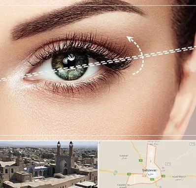 جراحی چشم گربه ای در سبزوار