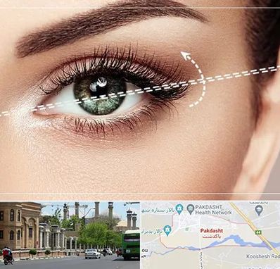 جراحی چشم گربه ای در پاکدشت