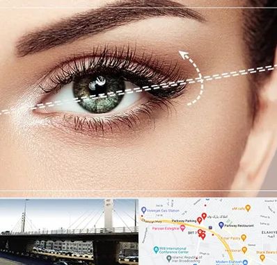 جراحی چشم گربه ای در پارک وی 