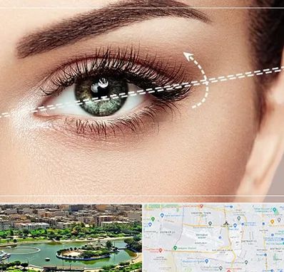 جراحی چشم گربه ای در منطقه 9 تهران 