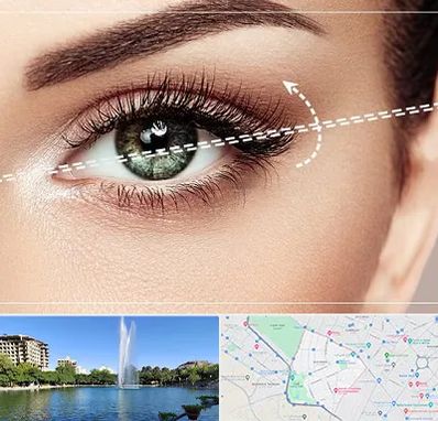 جراحی چشم گربه ای در کوهسنگی مشهد