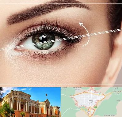 جراحی چشم گربه ای در خوی