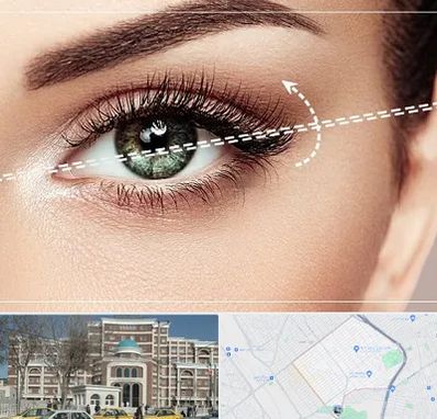 جراحی چشم گربه ای در طلاب مشهد