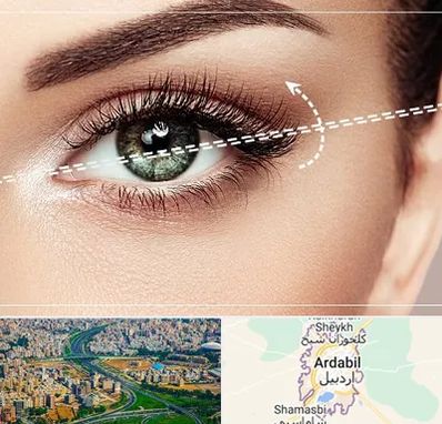 جراحی چشم گربه ای در اردبیل