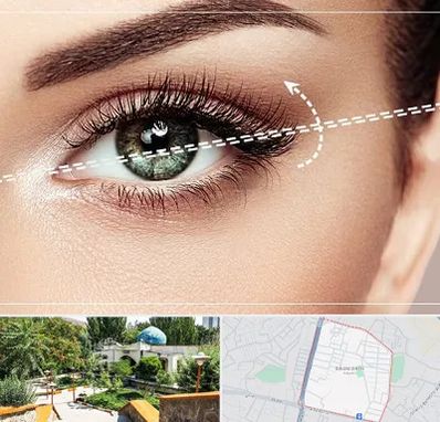 جراحی چشم گربه ای در باغمیشه تبریز