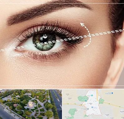 جراحی چشم گربه ای در کاشمر