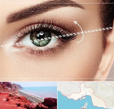 جراحی چشم گربه ای در هرمزگان