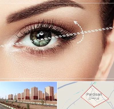 جراحی چشم گربه ای در پردیسان قم