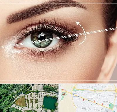جراحی چشم گربه ای در وکیل آباد مشهد 