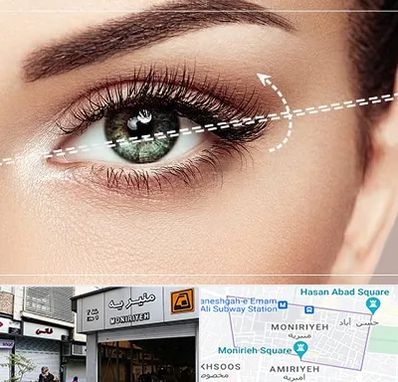 جراحی چشم گربه ای در منیریه 