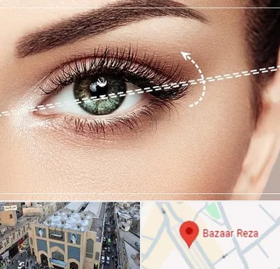 جراحی چشم گربه ای در بازار رضا مشهد