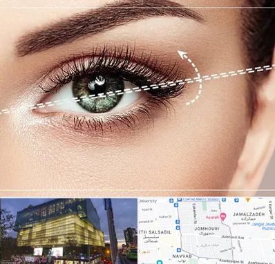 جراحی چشم گربه ای در جمهوری 