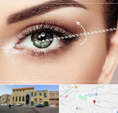 جراحی چشم گربه ای در زنبیل آباد قم