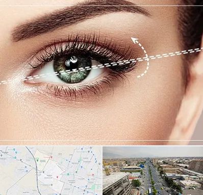 جراحی چشم گربه ای در حصارک کرج