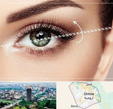 جراحی چشم گربه ای در ارومیه